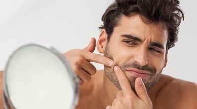 Acné: cómo se cura, tipos y tratamiento