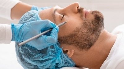 Las 3 operaciones estéticas preferidas por los hombres en 2023